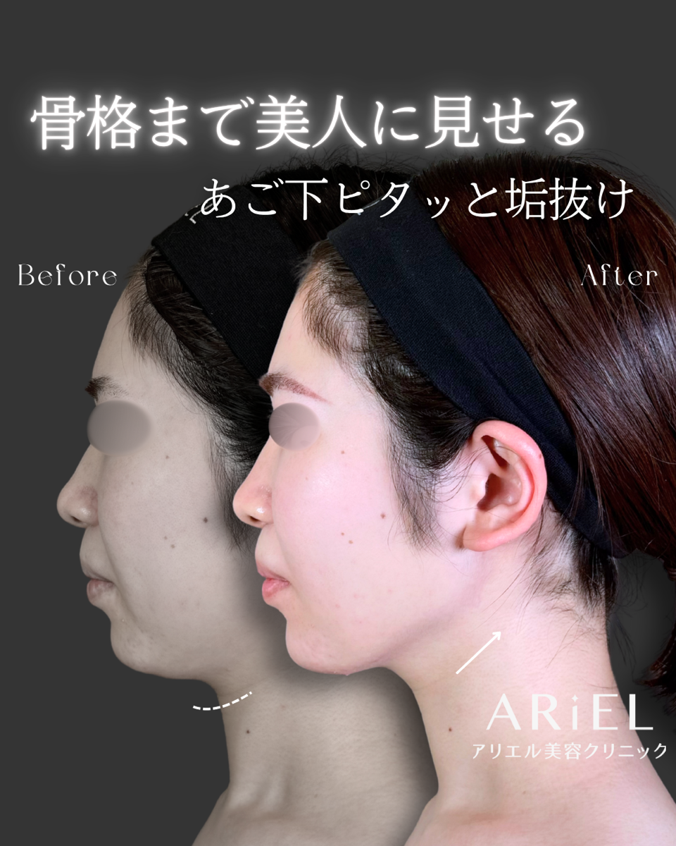 No.9209の症例写真